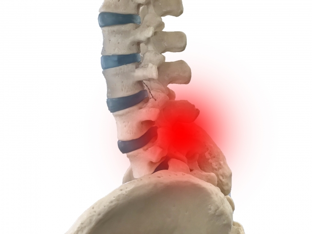 脊柱管狭窄症と姿勢の関係？原因を解明し、改善への道を探る